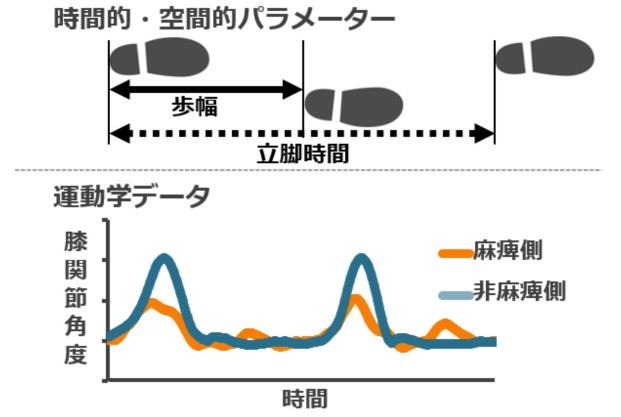 脳卒中片麻痺患者の歩行における時間的・空間的パラメーターと膝関節角度データ